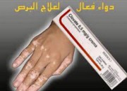 Photo de l'annonce: مزيل البرص